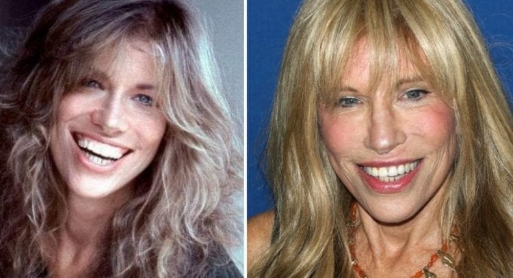 80s Pop Stars Carli simon 80s female singers- Then and now